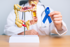 “Prevenir está en tus manos”: Capital Salud lanza campaña en el Meta para prevenir el cáncer colorrectal